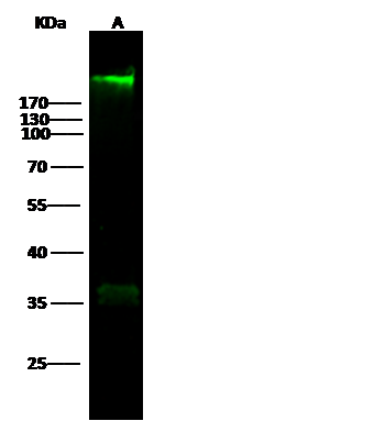 Recombinant Rabbit Monoclonal Antibody to Fibronectin (clone 014)